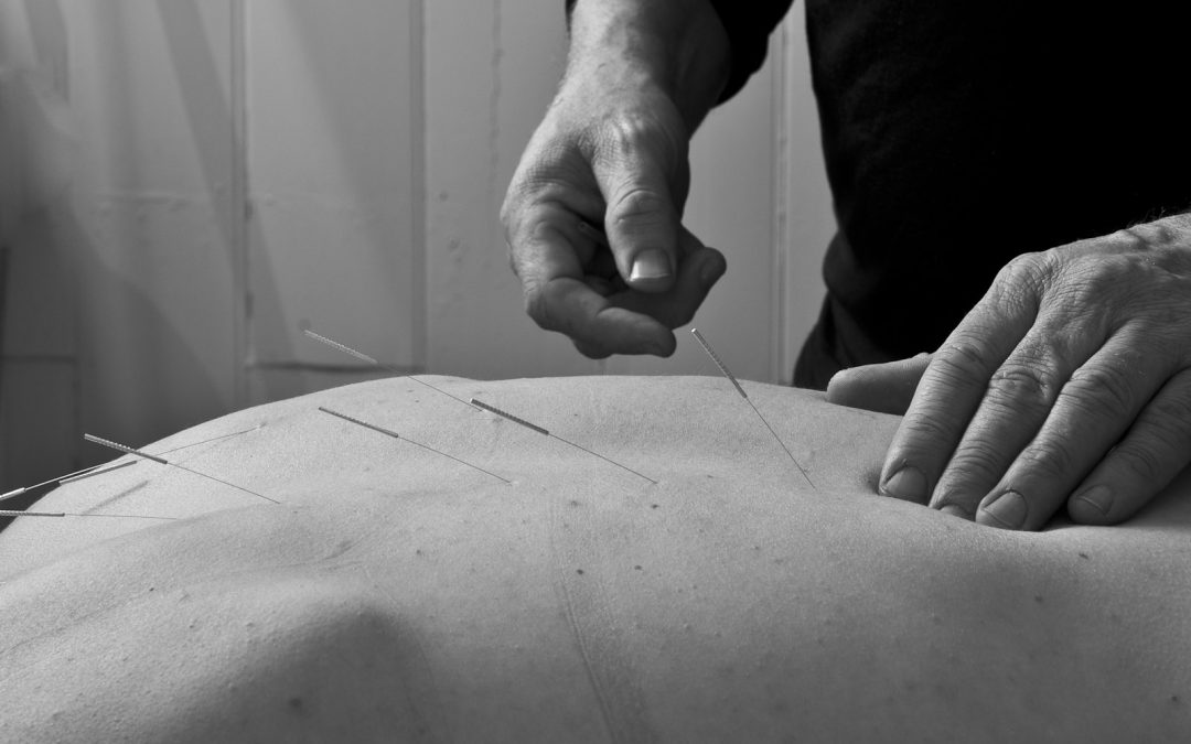 Integrated Dry Needling Intensive Sydney May 2018